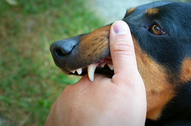 Suffered a Dog Bite Injury? Here are the Laws You Should Know About